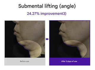 Dermafirm - Skin Tension Micro Crystal Patch 500 -6ea - Koreabe