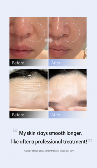 Arocell - Botulcare Primetox Mask 20ea