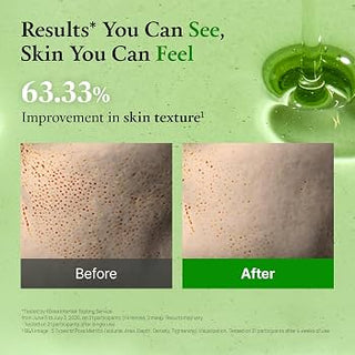 Fully - Acid 20 Wash Off Peeling Serum 50ml
