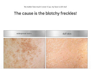 Medipeel - Melanonx Dark Spot Cream 30ml - Koreabe