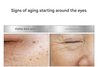 Medipeel - Melanonx Dark Spot Eye Cream 20ml - Koreabe