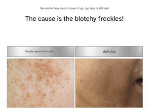 Medipeel - Melanonx Dark Spot Ampoule 30g - Koreabe