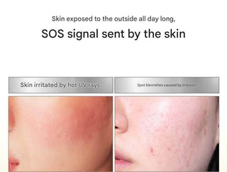 Medipeel - Melanonx Dark Spot Spot Gel 15ml - Koreabe