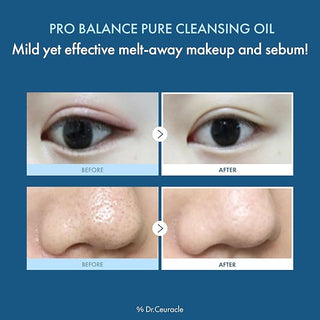 Dr Ceuracle - Pure Cleansing Oil 155ml