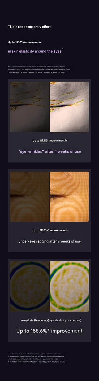 Melable - Utherable Tightening Eye Cream 600 Shot 15ml - Koreabe