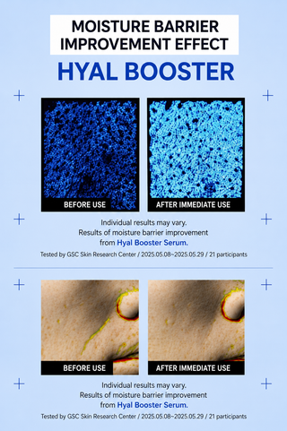 Toxnfill - Hyaluron Boosting Ampoule 30ml