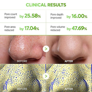 Dr Melaxin - Cactox 3 Step Nose Pore Pack