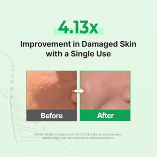 Zipiderm - EGF Skin Barrier Cleansing Foam 120ml