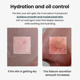 Ilso - Super Melting Sebum Cleansing Oil 200ml