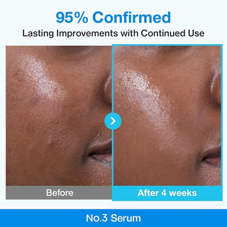 Numbuzin - Blu Bio Retinol Pore Refining Serum 30ml