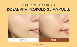 Dr Ceuracle - Royal Vita Propolis 33 Ampoule 30ml