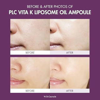 Dr Ceuracle - PLC Vita K Liposome Oil Ampoule 50ml