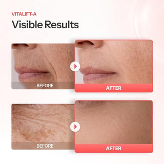 Dr Different - Vitalift A Cream 20ml