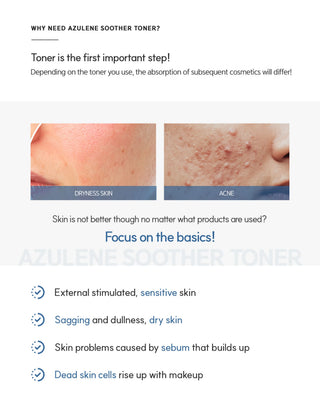 Dr Sante - Azulene Soother Toner 200ml