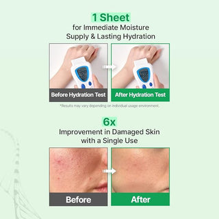 Zipiderm - EGF Skin Barrier Dressing Mask Pack 4ea