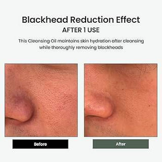 Delphyr - Liposome Daily Cleansing Oil 200ml - Koreabe