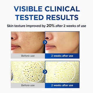 CKD - Vita C Teca Toning Shot Serum 30ml