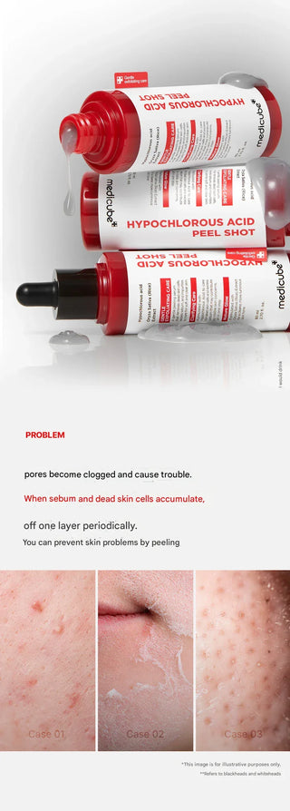 Medicube - Hypochlorous Acid Peel Shot 80ml - Koreabe
