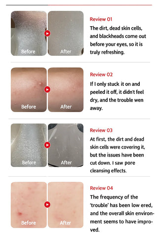 Medicube - Hypochlorous Acid Peel Mask 3ea - Koreabe