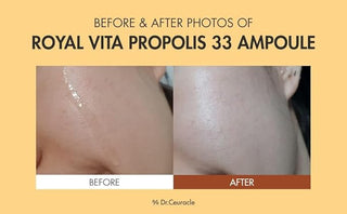 Dr Ceuracle - Royal Vita Propolis 33 Ampoule 30ml