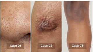 Medicube - Kojic Acid Tumeric Toning Cleanser 120g - Koreabe