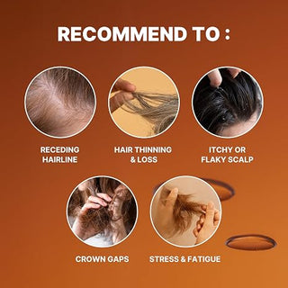Minoxell - Hair Loss Relief Shampoo 400ml