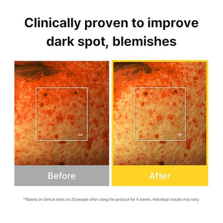 Cell Fusion C - Toning C Dark Spot Serum 30ml