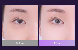 Bioheal - Collagen PDRN Eye Bag Patch 3ea