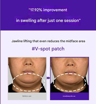 Dermafirm - Skin Tension Micro Crystal Patch 500 -6ea - Koreabe