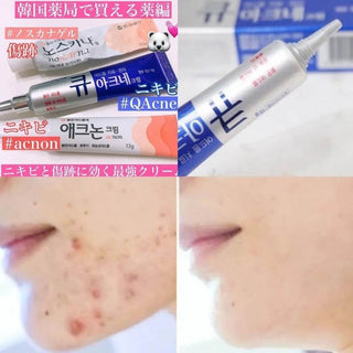 Kwangdong - Qacne Plus 15g - Koreabe