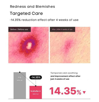 Dong A - Acne Pro Cream 30ml